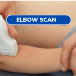 Elbow (Musculoskeletal) Scan Elbow (Musculoskeletal) Scan