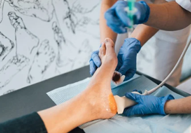 Plantar fascia ultrasound scan at UKSONO