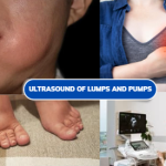 lumps scan uksono