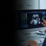 Bleeding in the first Trimester: causes, Assessment, and When to Seek Urgent Help. Pregnancy ultrasound images and a sonographer (1)