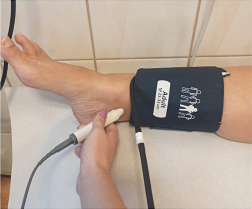 Ankle Brachial Index Doppler measurement being performed